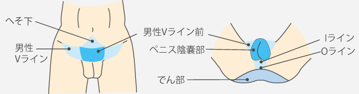 人気no 3 男性陰部脱毛 アンダーヘアー メンズ脱毛 福岡博多駅前